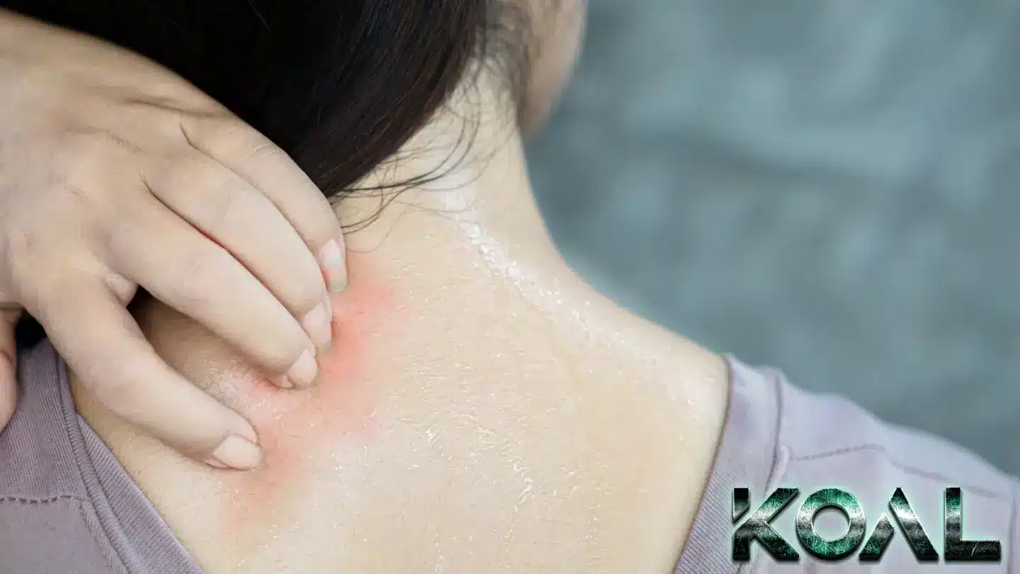 علت عرق زیاد پشت گردن چیست؟