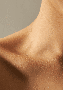  عرق كردن ناگهانی بدن