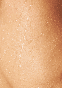  عرق كردن ناگهانی بدن